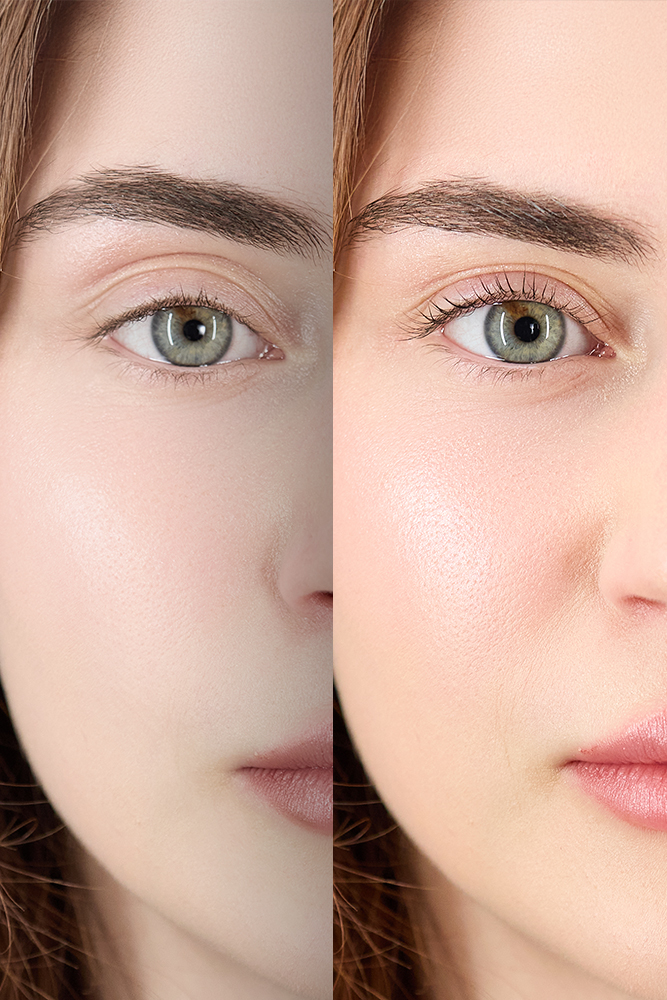 thebrash-occhio-dopo-2